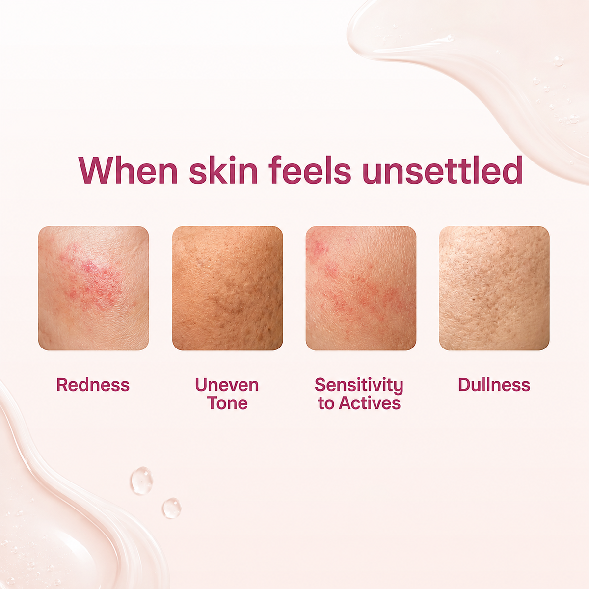 A skincare marketing graphic on a pale pink background with the headline 'When skin feels unsettled' and four square skin close-ups showing different issues: redness, uneven tone, sensitivity to actives, and dullness. Each panel is labeled with the corresponding text.