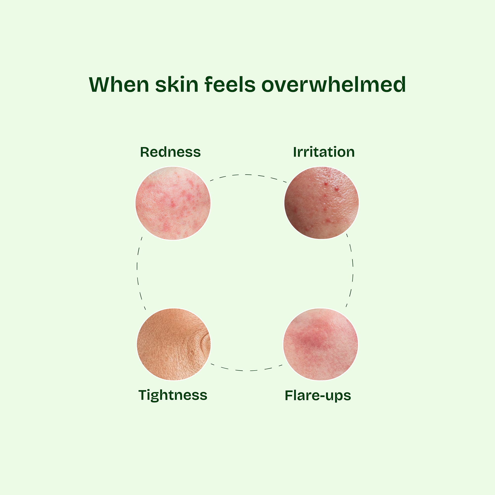 The Cica Soothing & Nurturing Cream